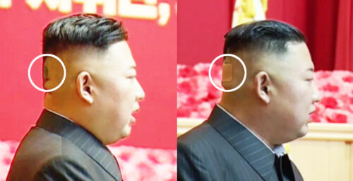 Mysterious spot and bandage appear on back of Kim Jong Un’s head
